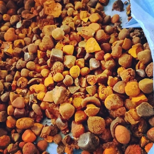 gallstone-ox